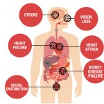 Why is high blood pressure bad?